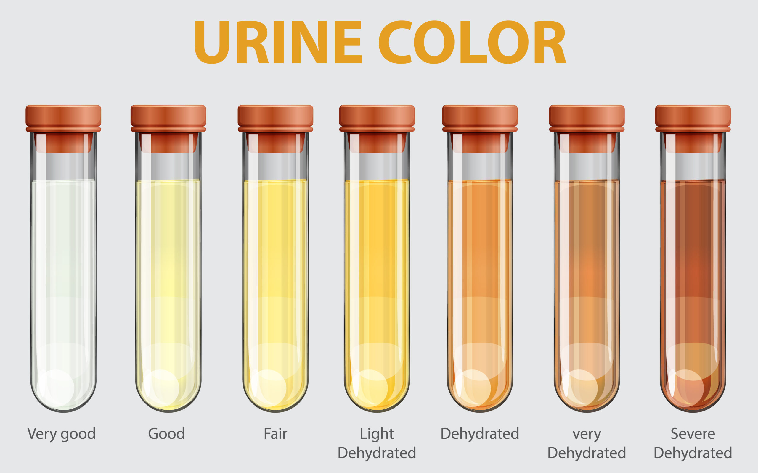 Urine Color